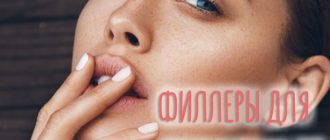 Филлеры для увеличения губ – ТОП-10