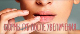 Формы губ после увеличения – результаты различных техник