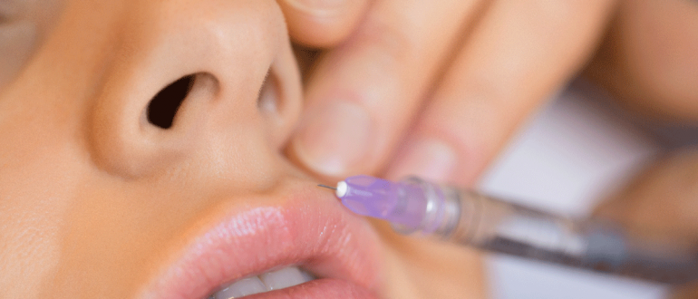 Французская техника увеличения губ – Парижская технология