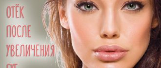 Отек после увеличения губ – все нюансы!