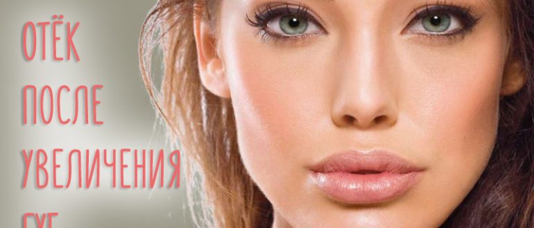 Отек после увеличения губ – все нюансы!