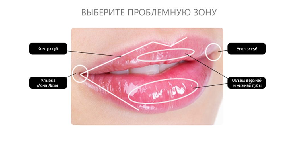 Как проходит процедура увеличения губ?