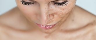 Уход после пилинга лица за кожей