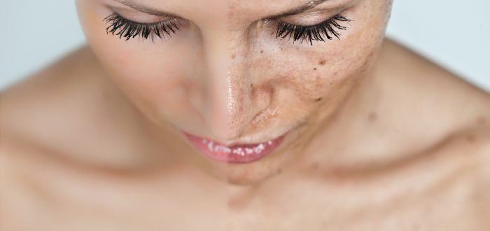 Уход после пилинга лица за кожей