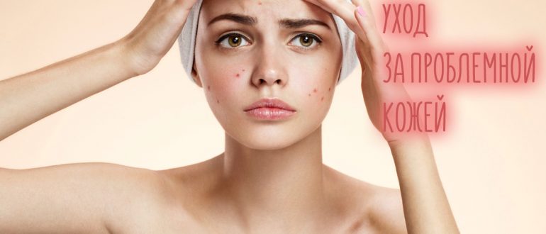 Уход за проблемной кожей лица в домашних условиях – бюджетные и профессиональные средства