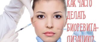 Биоревитализация – сколько процедур нужно для счастья, а также ответы на другие