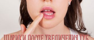 Что делать, если после увеличения губ гиалуроновой кислотой появились шарики?