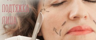 Что такое эндоскопическая подтяжка лица? Фото до и после операции, реабилитация