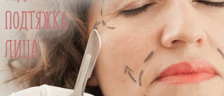 Что такое эндоскопическая подтяжка лица? Фото до и после операции, реабилитация