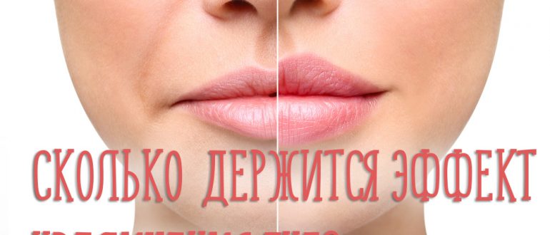 Что закачивают в губы для увеличения и сколько держится эффект?