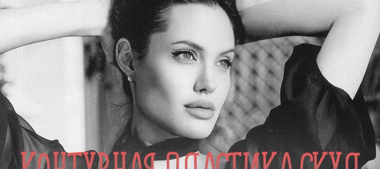 Как делается контурная пластика скул филлерами?