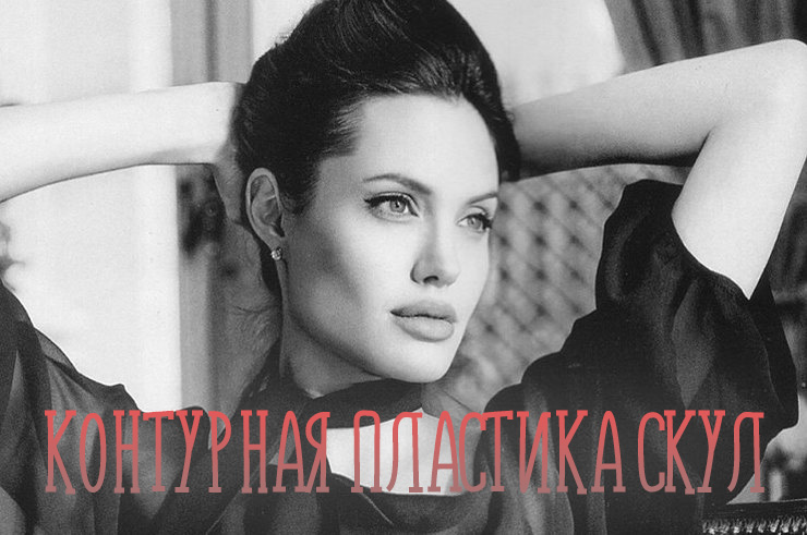 Как делается контурная пластика скул филлерами?