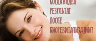 Когда виден результат после биоревитализации?