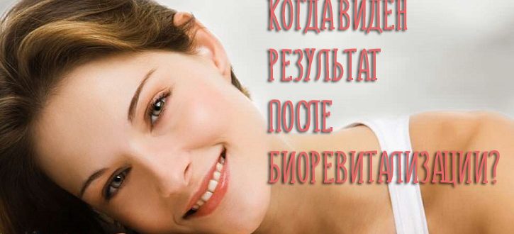 Когда виден результат после биоревитализации?