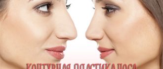 Контурная пластика носа – фото до и после