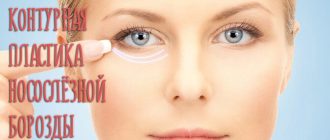 Контурная пластика носослёзной борозды