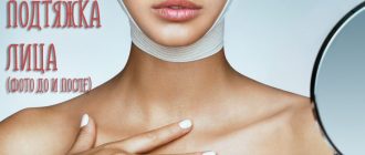 Круговая подтяжка лица. Отзывы, стоимость, фото до и после операции