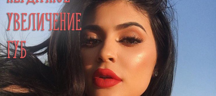 Неудачное увеличение губ гиалуроновой кислотой