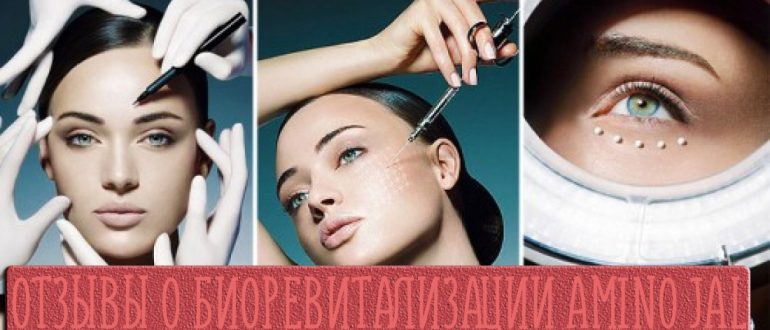 Отзывы о биоревитализации Аминояль Стронг (Amino Jal)