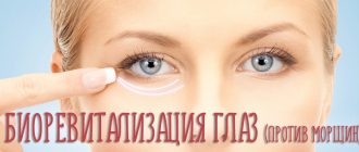 Отзывы о биоревитализации от морщин под глазами