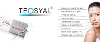 Отзывы о биоревитализации Теосиаль (Teosyal)