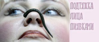 Пиявки в косметологии для подтяжки лица. Отзывы о гирудопластике