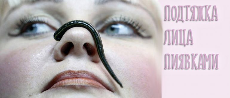 Пиявки в косметологии для подтяжки лица. Отзывы о гирудопластике