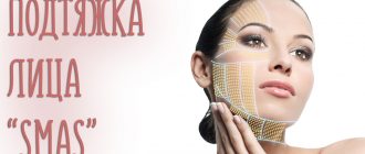 Подтяжка лица Смас – что это такое и как выглядит на фото?