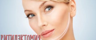 Ритидэктомия лица и шеи – что это такое и кому необходимо?