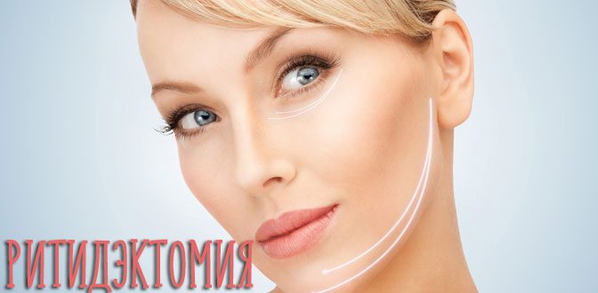Ритидэктомия лица и шеи – что это такое и кому необходимо?