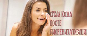 Сухая кожа после биоревитализации – как справиться с побочными эффектами?