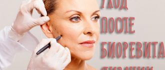 Уход после биоревитализации кожи лица – советы и запреты