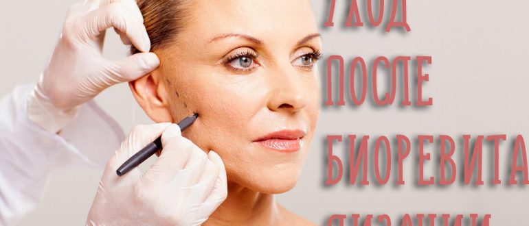 Уход после биоревитализации кожи лица – советы и запреты