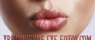 Увеличение губ ботоксом – ответы на популярные вопросы