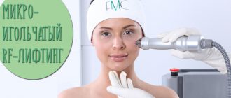 Микроигольчатый RF лифтинг – виды и отзывы