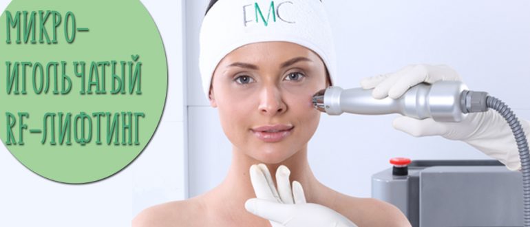Микроигольчатый RF лифтинг – виды и отзывы