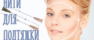Нити для подтяжки лица. Виды, отзывы, осложнения