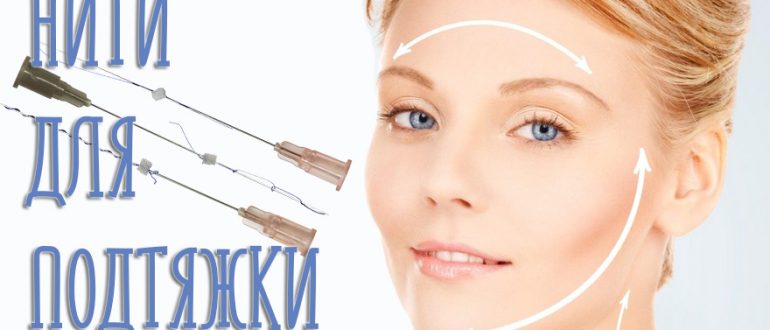 Нити для подтяжки лица. Виды, отзывы, осложнения