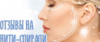 Нити спирали для подтяжки лица. Отзывы, фото до и после операций