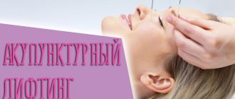 Отзывы на акупунктурный лифтинг лица