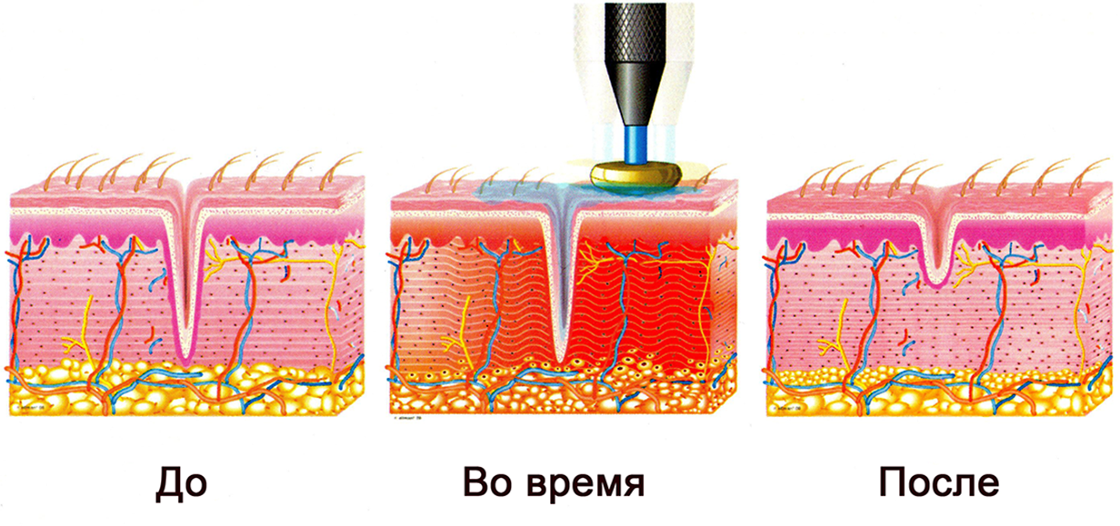 Мультиполярный