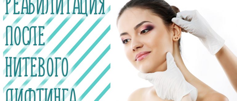 Реабилитация после нитевого лифтинга: длительность и особенности
