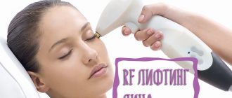 RF лифтинг лица – что это такое? Фото до и после процедур