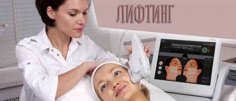 Альтера лифтинг SMAS и вся правда об ультразвуковой системе Ulthera System