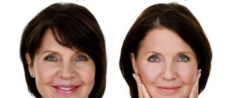 крем для лица с пептидами против морщин