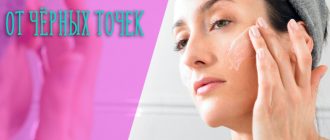 Причины появления чёрных точек