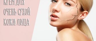 Крем для очень сухой кожи лица в аптеке – как выбрать средство для восстановления?