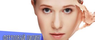 Что такое Феруловый пилинг
