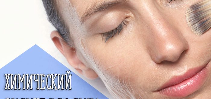 Что такое химический пилинг