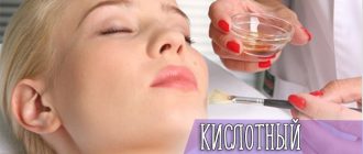 Суть методики